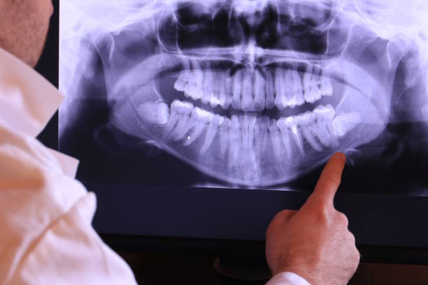 Best Dental Abscess Treatment in Sullivan Gardens, TN